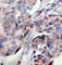 Janus Kinase 2 antibody, AP0374, ABclonal Technology, Immunohistochemistry paraffin image 
