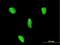 Lim3 antibody, H00008022-M08, Novus Biologicals, Immunocytochemistry image 