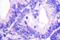 WASP Family Member 1 antibody, PA5-36760, Invitrogen Antibodies, Immunohistochemistry paraffin image 