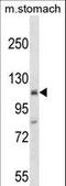 Suppression of tumorigenicity 18 protein antibody, LS-C157936, Lifespan Biosciences, Western Blot image 