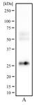CD81 Molecule antibody, TA336485, Origene, Western Blot image 