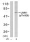 LIM Domain Kinase 1 antibody, GTX79023, GeneTex, Western Blot image 
