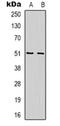 WAS/WASL Interacting Protein Family Member 1 antibody, orb318836, Biorbyt, Western Blot image 