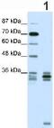 Oligodendrocyte Transcription Factor 2 antibody, ab42453, Abcam, Western Blot image 