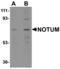 Notum, Palmitoleoyl-Protein Carboxylesterase antibody, A03235, Boster Biological Technology, Western Blot image 