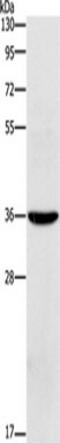 Oxidized Low Density Lipoprotein Receptor 1 antibody, TA349624, Origene, Western Blot image 
