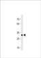 Homeobox protein Hox-B8b antibody, PA5-72625, Invitrogen Antibodies, Western Blot image 