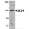 Zinc Finger E-Box Binding Homeobox 1 antibody, MBS151570, MyBioSource, Western Blot image 