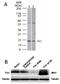 Mitochondrial fission 1 protein antibody, PA1-41082, Invitrogen Antibodies, Western Blot image 