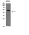 Transforming Growth Factor Beta 1 Induced Transcript 1 antibody, STJ98611, St John