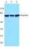 BMX Non-Receptor Tyrosine Kinase antibody, PA5-36787, Invitrogen Antibodies, Western Blot image 