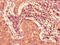 Family With Sequence Similarity 160 Member A2 antibody, LS-C399478, Lifespan Biosciences, Immunohistochemistry paraffin image 