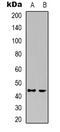 Cyclin Dependent Kinase 15 antibody, LS-C368843, Lifespan Biosciences, Western Blot image 