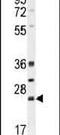 BCL10 Immune Signaling Adaptor antibody, PA5-24191, Invitrogen Antibodies, Western Blot image 