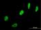 Small Nuclear Ribonucleoprotein Polypeptide N antibody, H00008926-B01P, Novus Biologicals, Immunofluorescence image 