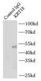 Keratin 18 antibody, FNab02205, FineTest, Immunoprecipitation image 