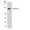 Zinc Finger Protein 420 antibody, LS-C292224, Lifespan Biosciences, Western Blot image 