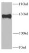 Presequence protease, mitochondrial antibody, FNab06472, FineTest, Western Blot image 