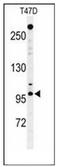Nucleoporin 210 antibody, AP52972PU-N, Origene, Western Blot image 