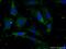 Radial spoke head protein 3 homolog antibody, 17603-1-AP, Proteintech Group, Immunofluorescence image 