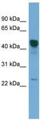 Dyslexia susceptibility 1 candidate gene 1 protein antibody, TA340263, Origene, Western Blot image 