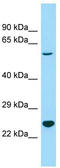 Divergent Protein Kinase Domain 2A antibody, TA330958, Origene, Western Blot image 