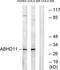 Abhydrolase Domain Containing 11 antibody, TA315870, Origene, Western Blot image 