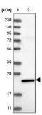 Fetal and adult testis-expressed transcript protein antibody, NBP1-85402, Novus Biologicals, Western Blot image 