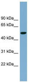 Solute carrier family 2, facilitated glucose transporter member 8 antibody, TA333867, Origene, Western Blot image 