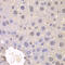 Fibroblast Growth Factor Receptor 1 antibody, LS-C331878, Lifespan Biosciences, Immunohistochemistry paraffin image 