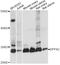 Developmental pluripotency-associated protein 2 antibody, A14966, ABclonal Technology, Western Blot image 