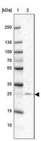 Regulating Synaptic Membrane Exocytosis 4 antibody, PA5-63911, Invitrogen Antibodies, Western Blot image 