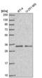 Coiled-Coil Domain Containing 107 antibody, NBP2-58785, Novus Biologicals, Western Blot image 