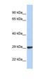 Zinc Finger CCHC-Type Containing 24 antibody, orb326012, Biorbyt, Western Blot image 