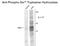 Tryptophan Hydroxylase 1 antibody, GTX82574, GeneTex, Western Blot image 