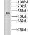 Clusterin Associated Protein 1 antibody, FNab01780, FineTest, Western Blot image 