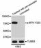 Bruton Tyrosine Kinase antibody, abx125441, Abbexa, Western Blot image 