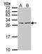 Natriuretic Peptide B antibody, LS-C185374, Lifespan Biosciences, Western Blot image 