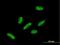 Hypermethylated in cancer 2 protein antibody, H00023119-B01P, Novus Biologicals, Immunocytochemistry image 