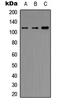 Histone Deacetylase 5 antibody, abx121495, Abbexa, Western Blot image 