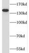 Pumilio homolog 2 antibody, FNab06955, FineTest, Western Blot image 