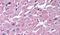 Cysteinyl Leukotriene Receptor 2 antibody, PA5-32717, Invitrogen Antibodies, Immunohistochemistry frozen image 