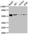 Zinc Finger DHHC-Type Containing 14 antibody, CSB-PA811637LA01HU, Cusabio, Western Blot image 