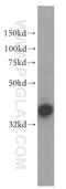 NSF Attachment Protein Gamma antibody, 15604-1-AP, Proteintech Group, Western Blot image 