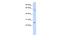 Family With Sequence Similarity 124 Member A antibody, A14809, Boster Biological Technology, Western Blot image 