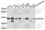 Protein Kinase AMP-Activated Non-Catalytic Subunit Beta 1 antibody, A0846, ABclonal Technology, Western Blot image 