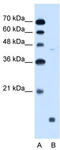 Sphingosine-1-Phosphate Receptor 5 antibody, TA329488, Origene, Western Blot image 