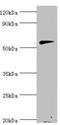 Beta-Ala-His dipeptidase antibody, orb352549, Biorbyt, Western Blot image 