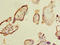 Myoneurin antibody, A59974-100, Epigentek, Immunohistochemistry paraffin image 