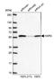 Histidyl-TRNA Synthetase antibody, HPA036539, Atlas Antibodies, Western Blot image 